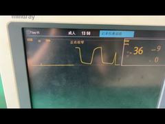 Un examen plus attentif : Piège à eau Mindray pour module de gaz d'anesthésie pédiatrique adulte 9200-10-10530